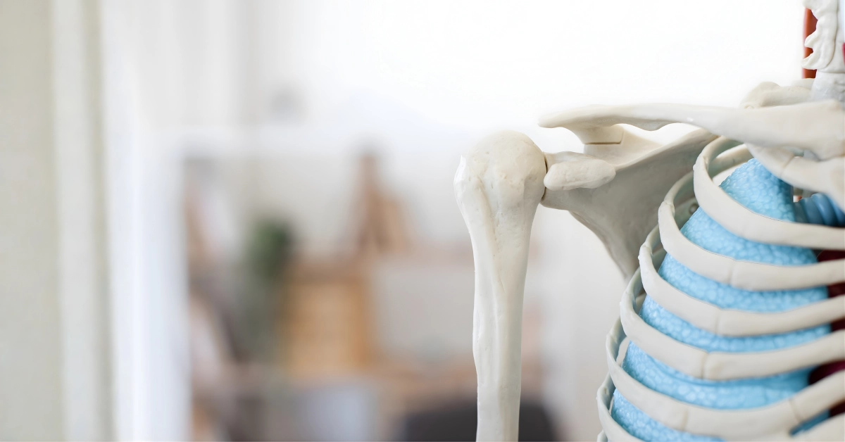 Köprücük kemiği kırığı sonrası iyileşme.