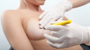 افزایش سایز سینه با تزریق چربی در ترکیه