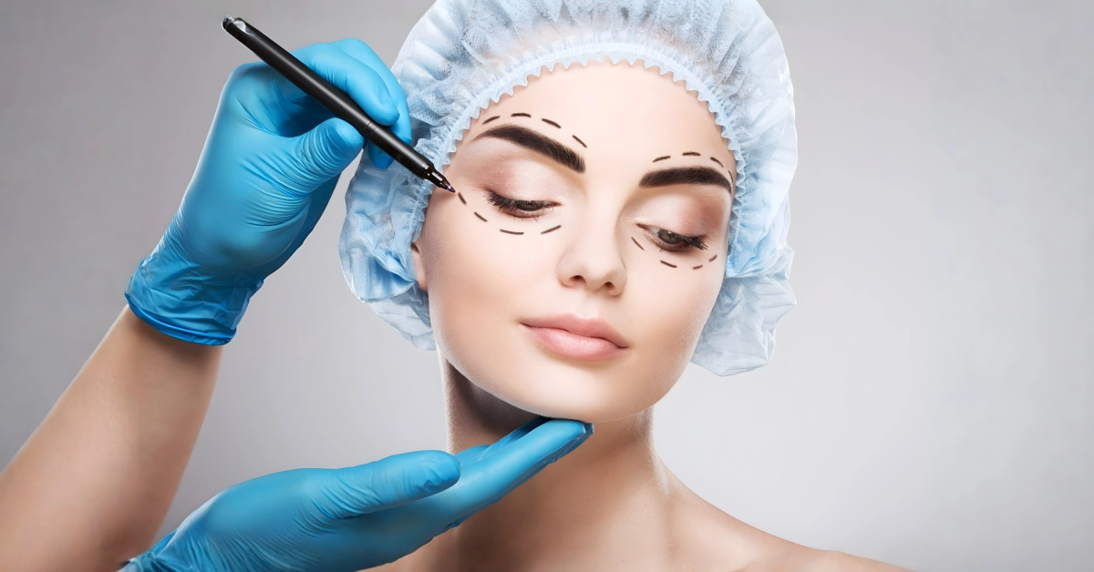 Blefaroplasti ile göz kapağı estetiği uygulaması.