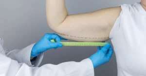 Kol ve bacak germe operasyonu sonrası sıkı ve estetik vücut görünümü sağlayan estetik cerrahi uygulama