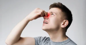 Endoscopic Nasal Polyp Removal Surgery in Turkey