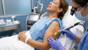 Scar Revision Procedures in Turkey