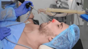 جراحی سینوس به روش آندوسکوپیک در استانبول